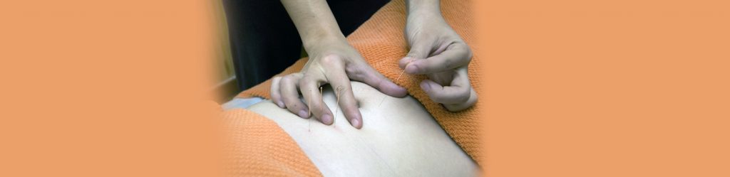 banner-acupuncture